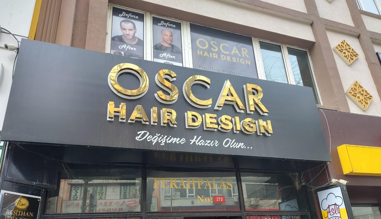 Kaliteli Protez Saçlar Oscar Hair’de En Uygun Fiyatlarla Yapılıyor